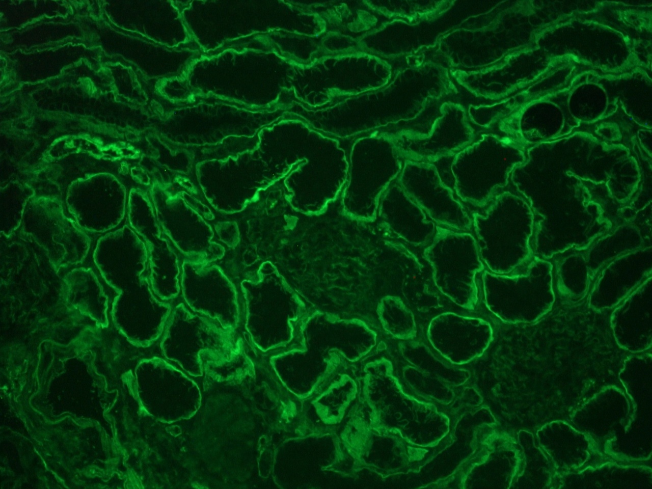 Figure 4: Integrin alpha 6A immunostaining of the basolateral membrane of epithelial cells in a frozen section of human kidney using MUB0908P.